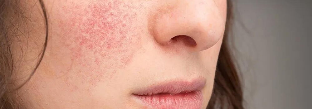 冬季干燥,温湿度传感器如何帮助我们调整室内湿度?